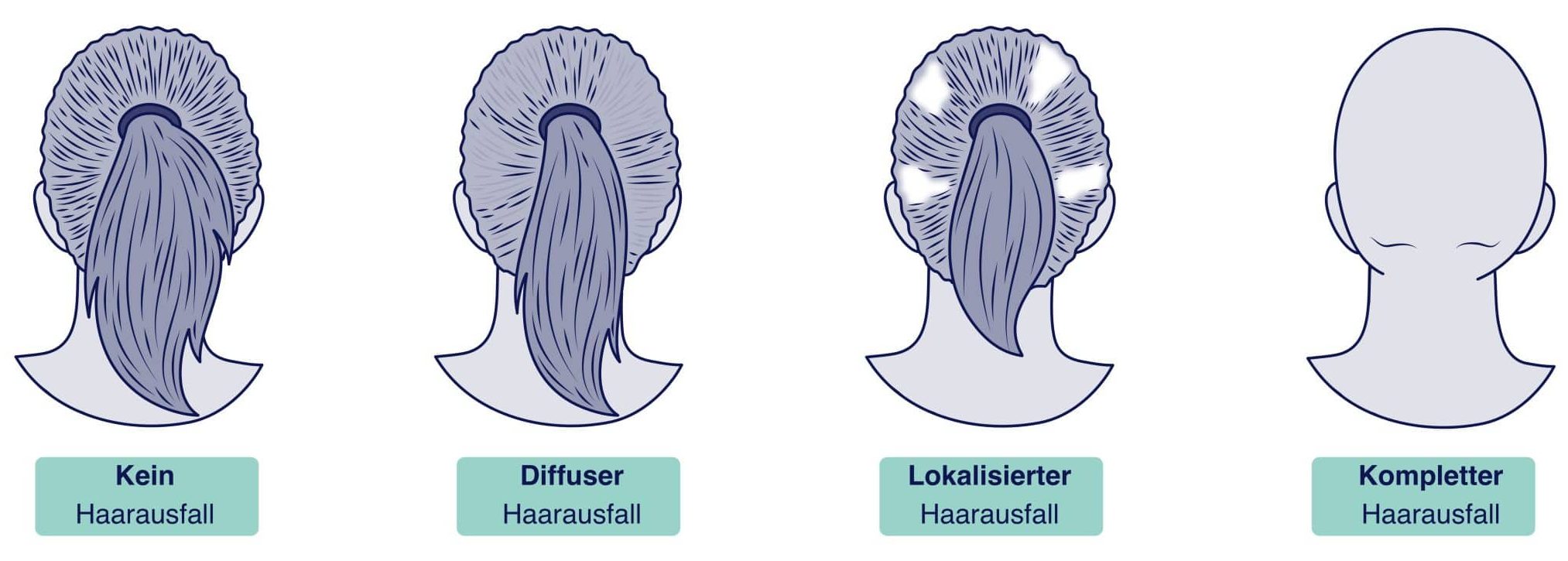 Haarausfall