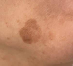 Typischer Sonnenfleck