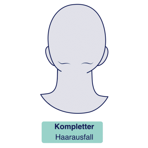 Haarausfall vollständig