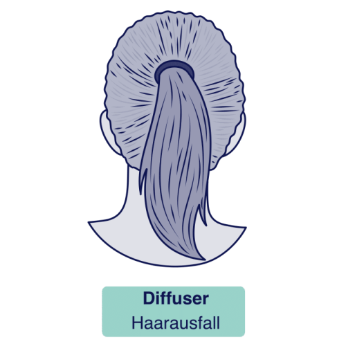 Diffuser Haarausfall