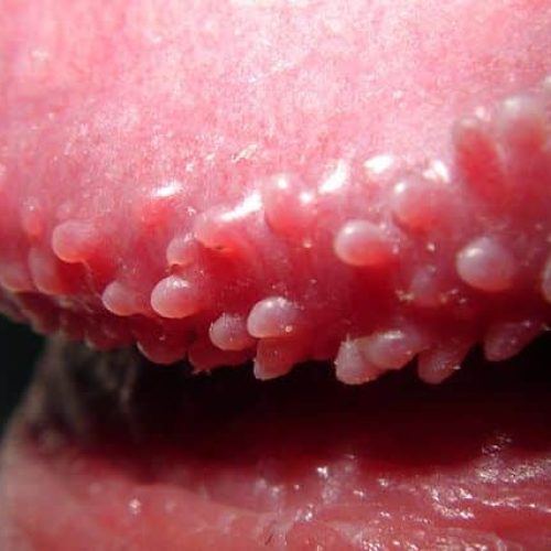 Hornzipfel Nahaufnahme